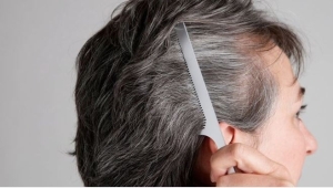 Mẹo cơ bản ngăn ngừa tóc bạc sớm