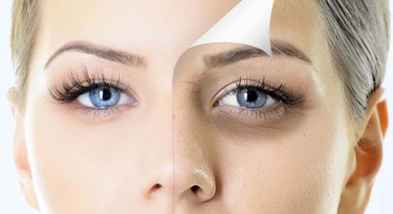 Giúp giảm thâm quầng cho mắt bằng những loại mặt nạ sau