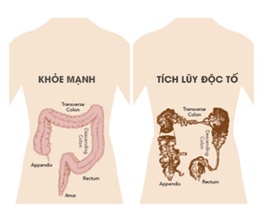 Hãy cùng loại bỏ các độc tố ra khỏi cơ thể