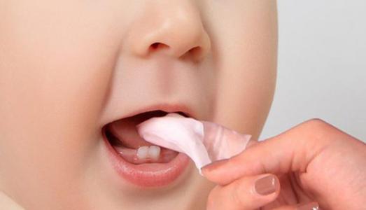Cách xử lý răng nanh của trẻ sơ sinh