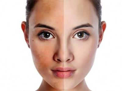 4 dấu hiệu chứng tỏ cơ thể bước vào giai đoạn lão hóa