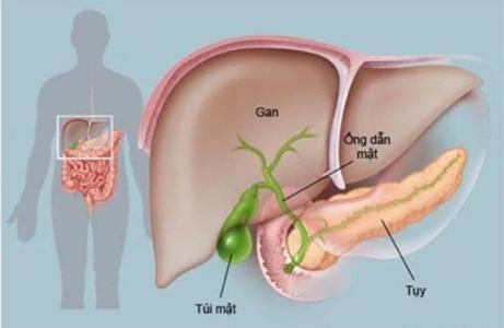 Dấu hiệu cảnh báo ung thư tuyến tụy không thể chủ quan