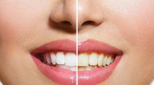 10 thói quen khiến hàm răng hư hỏng mọi người nên tránh
