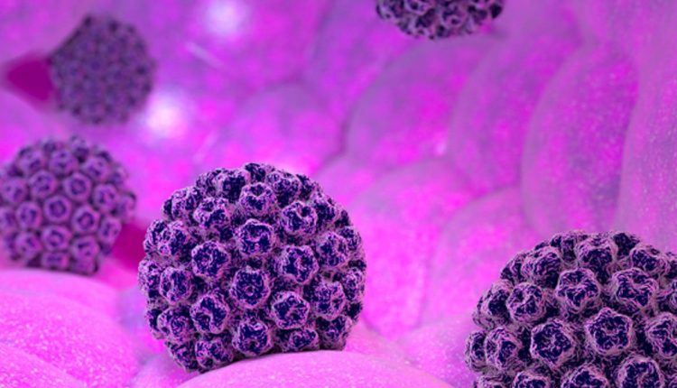 Bị nhiễm virus HPV sẽ có 3 điểm ‘giống nhau’ khi đi vệ sinh các chị em cần lưu ý