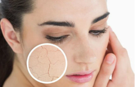 Sai lầm thường gặp khi dưỡng ẩm làm da ngày càng khô ráp hơn