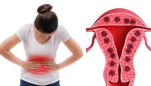 Hiện tượng kinh nguyệt và dấu hiệu rối loạn kinh nguyệt