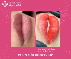 Xu huwóng Phun môi Cherry Lip vừa ra mắt đã trở thành xu hướng