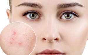 Kiểu tổn thương da thường gặp và cách khắc phục đơn giản