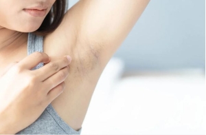 Mẹo cải thiện tình trạng vùng da dưới cánh tay