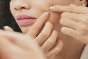 Mách bạn cách trị mụn ẩn hiệu quả tại nhà, ngừa tái phát, không để lại sẹo