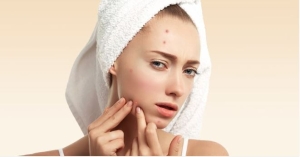 Nguyên tắc cơ bản khi giảm sưng mụn viêm