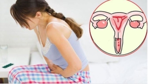 Dấu hiệu nghi ngờ ung thư cổ tử cung chị em cần biết