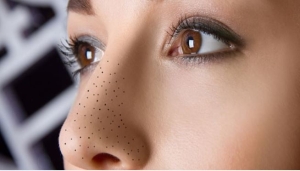 Dễ gây ra tình trạng mụn đầu đen với 5 thói quen tưởng chừng vô hại lại 