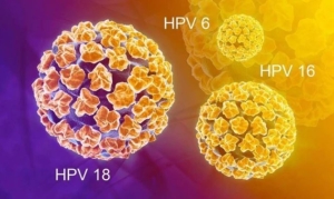 Cần biết chủng virus HPV nào dễ gây ung thư cổ tử cung nhất?