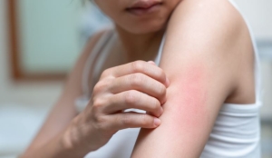 Khi bị ngứa da, vì sao càng gãi lại càng nặng hơn