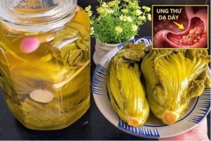 Vợ chồng cùng mắc ung thư vì ăn loại rau quen thuộc này mỗi ngày