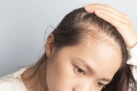 Giải mã sự thật về rụng tóc khi dùng biện pháp tránh thai nội tiết tố