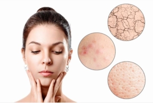 Những cách giúp làn da sạch khỏe và tươi sáng hơn