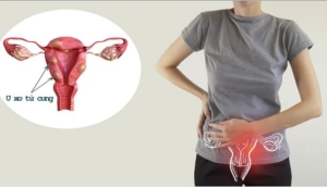 Cảnh báo bệnh khi bị rong kinh?