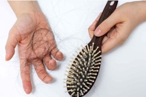 Dấu hiệu bình thường hay cảnh báo bất ổn khi rụng tóc nhiều và cách cải thiện an toàn tại nhà