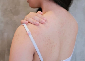 Routine đơn giản giúp da body mịn màng rõ rệt cải thiện mụn lưng và da sần sùi tại nhà