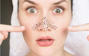 Những thói quen chăm sóc da khiến mụn đầu đen ngày càng nghiêm trọng