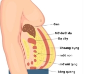 Mỡ nội tạng nguy hiểm hơn mỡ dưới da như thế nào
