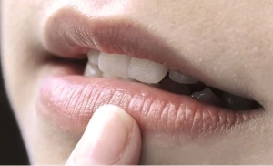 4 thói quen khiến môi ngày càng thâm sạm