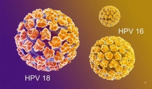 3 hiểu lầm phổ biến về ung thư cổ tử cung và cách chủ động phòng ngừa