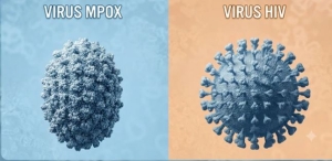 Mpox ở người nhiễm HIV: Khi nào bệnh có nguy cơ diễn biến nặng