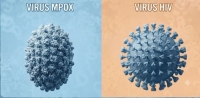 Mpox ở người nhiễm HIV: Khi nào bệnh có nguy cơ diễn biến nặng