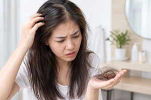 8 nguyên nhân gây rụng tóc, hói đầu và cách khắc phục